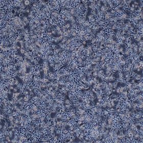 人乳腺导管癌细胞MDA-MB-435S(STR正确)DMEM