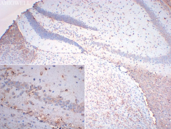 image.png 艾碧維KiSS-1R兔多克隆抗體