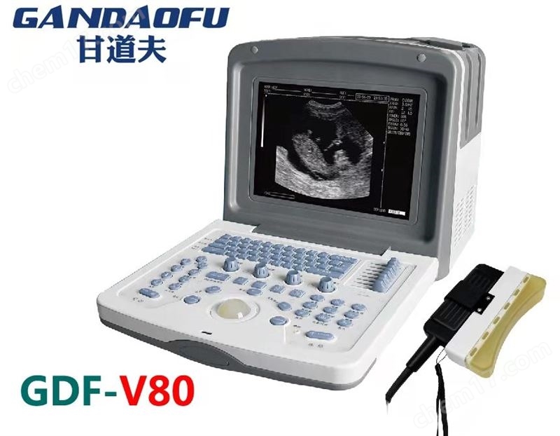 采購(gòu)背膘眼肌面積測(cè)定儀品牌廠家報(bào)價(jià)價(jià)格