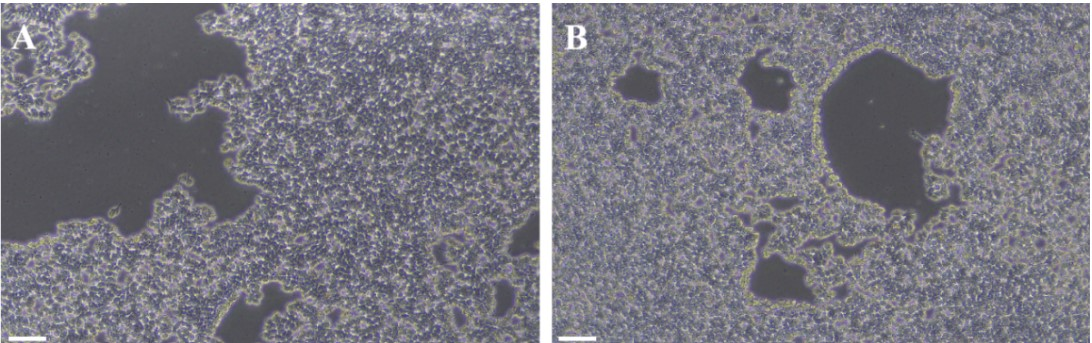 hiPSC细胞消化形态图