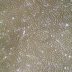 LONZA原代人髂動(dòng)脈內(nèi)皮細(xì)胞HIAEC和培養(yǎng)基 產(chǎn)品介紹