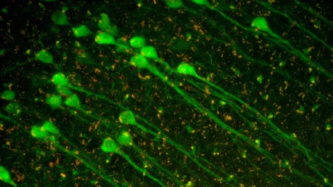 显微课堂 | 神经科学研究指南